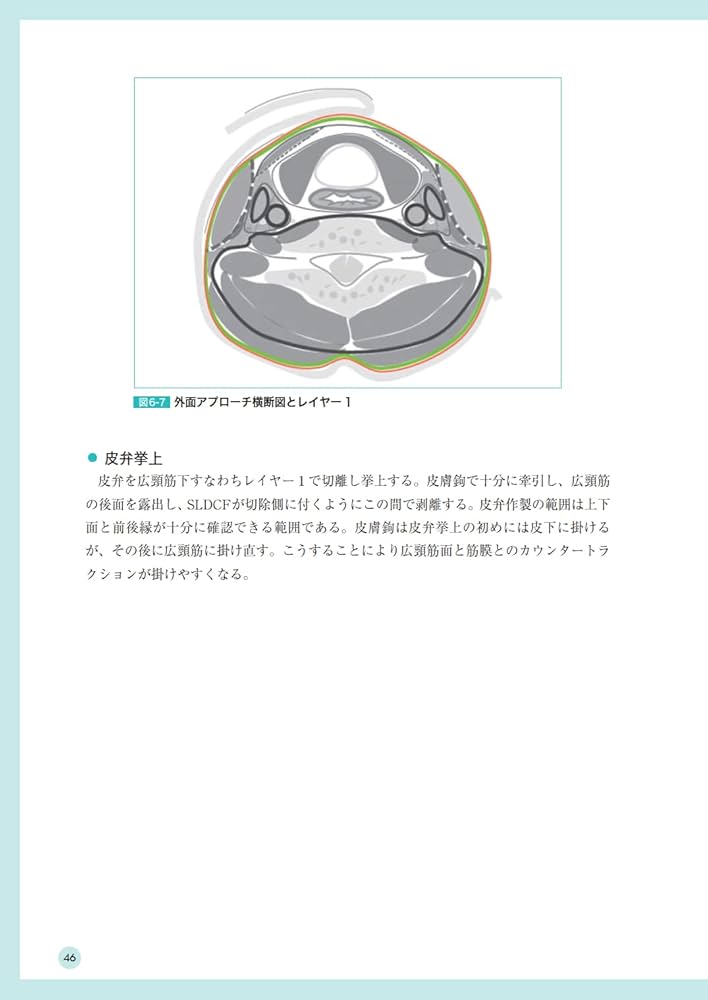 Amazon.co.jp: 頭頸部がん手術ノート 輪層の外科 : 長谷川 泰久