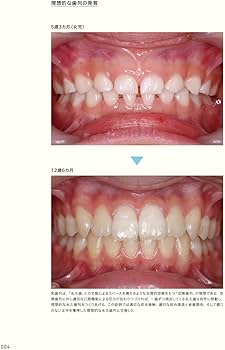 口腔習癖 見逃してはいけない小児期のサイン | 河井 聡 |本 | 通販