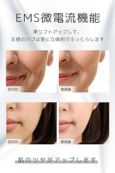Amazon.co.jp: 【2025革新登場】Nizmir 美顔器 EMS美顔器 EMS 多機能