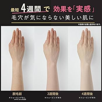 Amazon | JOVS Dora SRモード搭載 2024年型 脱毛器 家庭用 メンズ髭