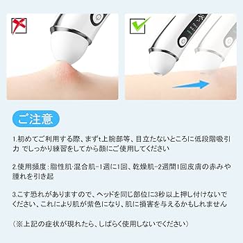 Amazon.co.jp: 毛穴吸引器 カメラ付き 角栓吸引器 可視化毛穴吸引器