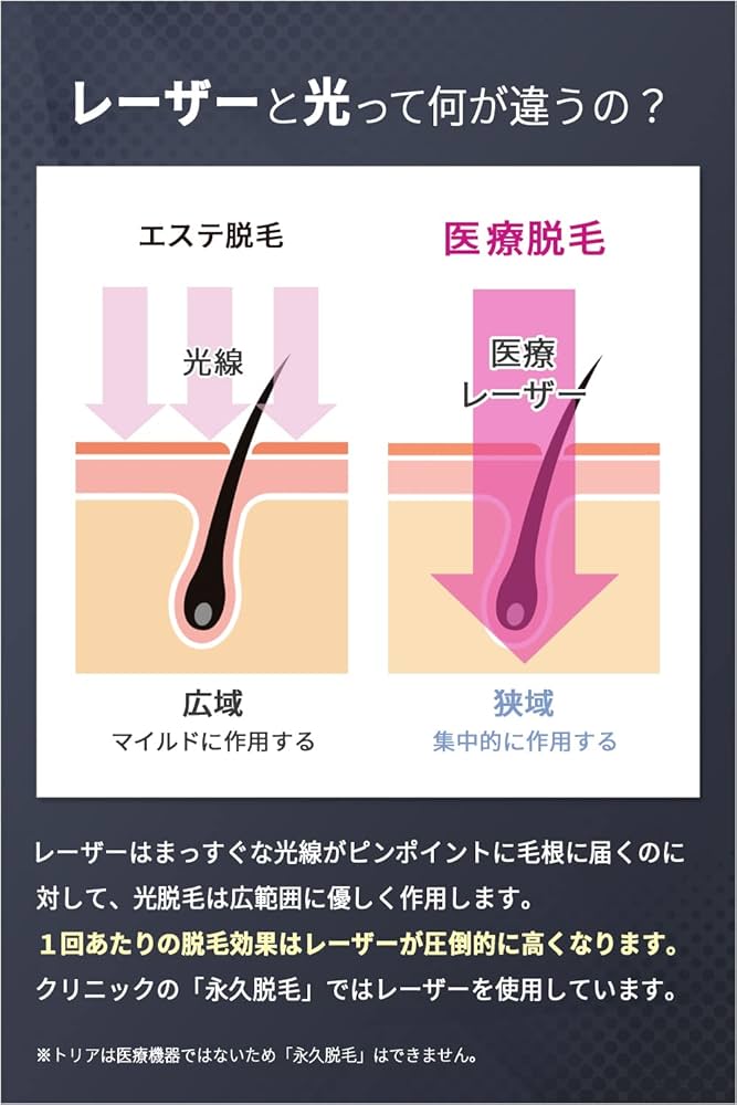 Amazon.co.jp: Tria Personal Laser Epilator Precision Laser Hair