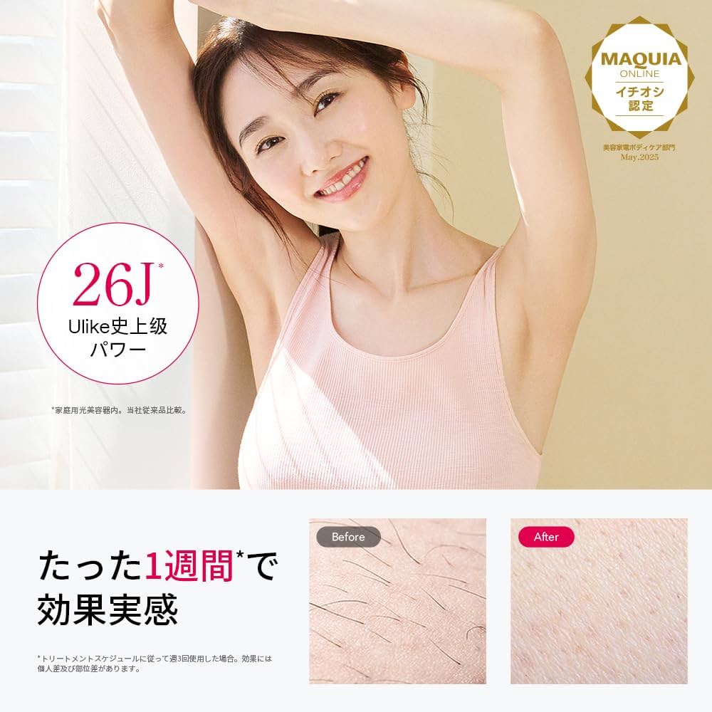 Amazon | 【正規品】Ulike 脱毛器 Air10 光美容器 髭/脇/VIO/脚/腕