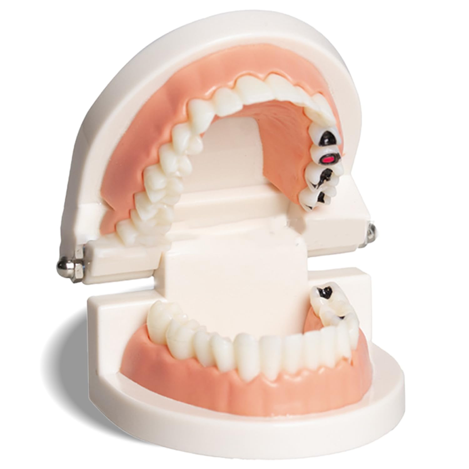 Amazon.co.jp: KIYOMARU パカっと開口できる虫歯付き歯列模型 人体模型