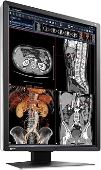 Amazon.co.jp: EIZO RadiForce RX250 縦型 21.3インチ ワイド モニタ