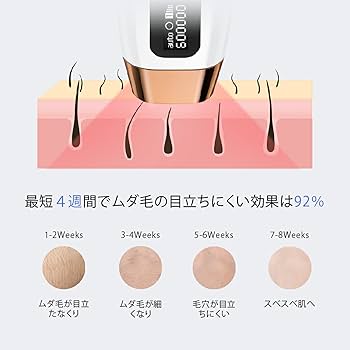 Amazon.co.jp: 家庭用脱毛器 COSBEAUTY IPL光美容器 Flash Version