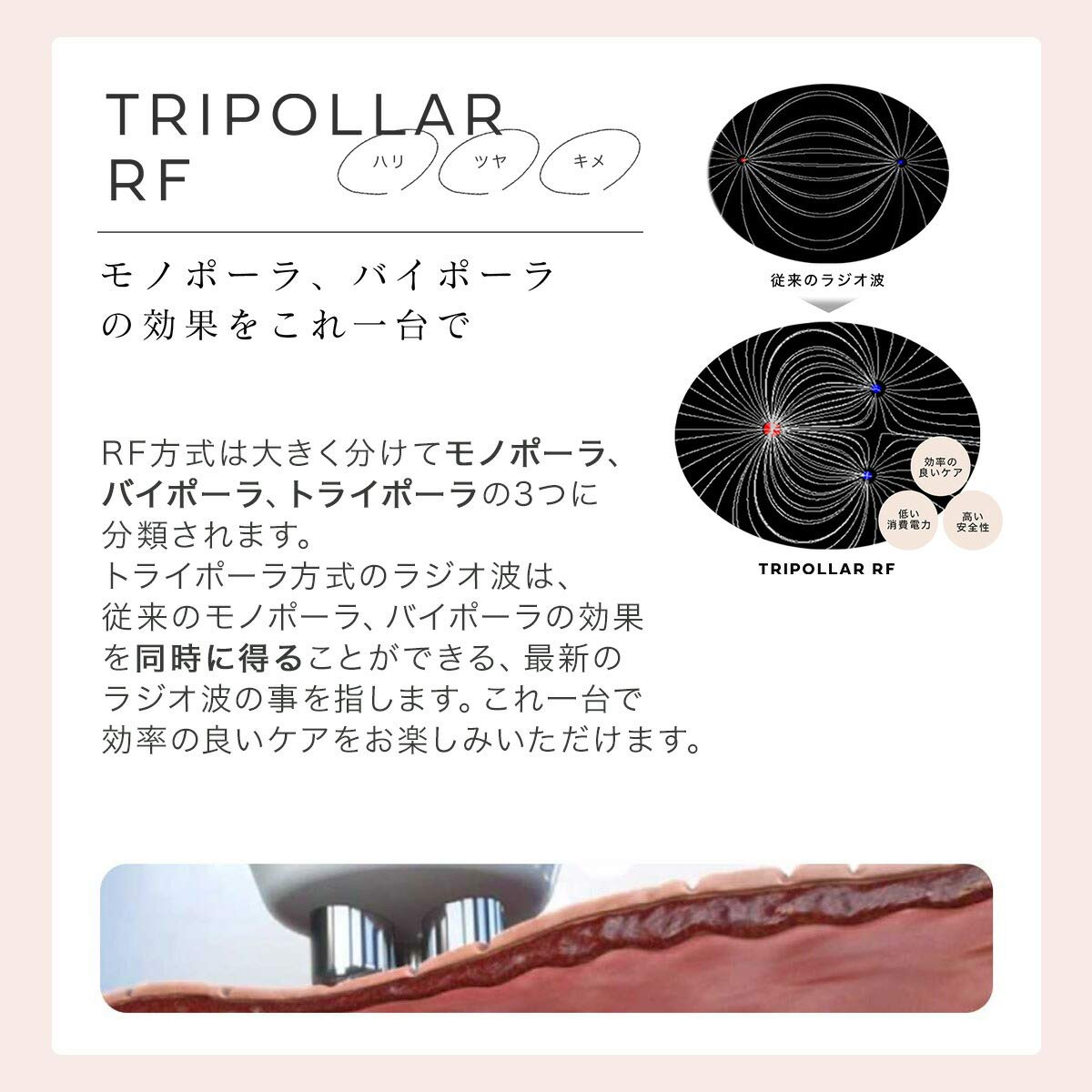 Amazon.co.jp: TriPollar STOPV トライポーラ ストップヴイ RF高周波