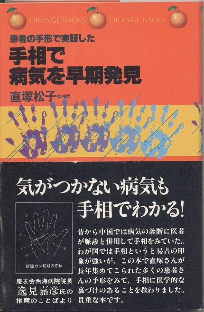 Amazon.co.jp: 手相で病気を早期発見―患者の手形で実証した (1981年