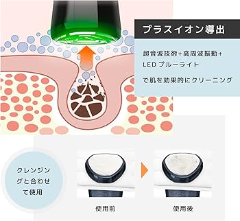 Amazon.co.jp: Le Dzx 美顔器 【最新登場 最新冷感エステ技術】美容器