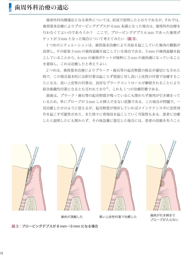 ゼロから見直す歯周外科治療 | 松延 允資 |本 | 通販 | Amazon