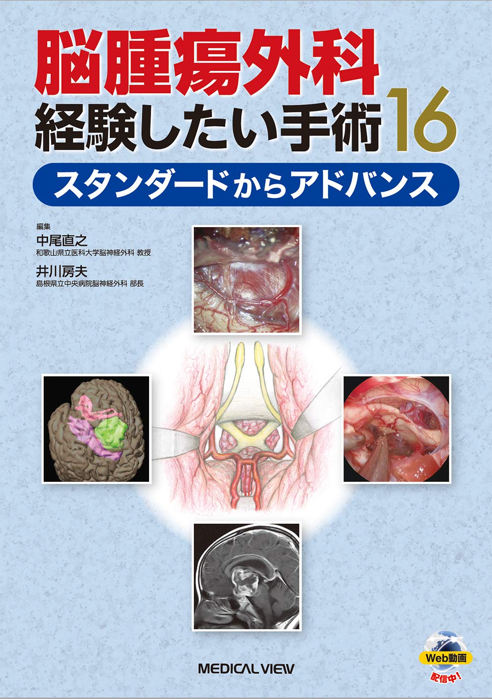 脳腫瘍外科 経験したい手術16−スタンダードからアドバンス | 中尾