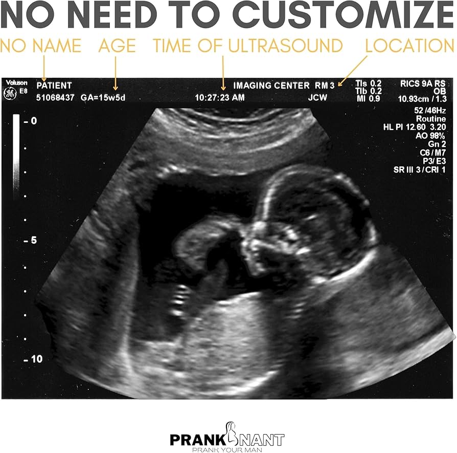 Amazon.co.jp: いたずら偽の超音波いたずら写真|3枚の写真の2D