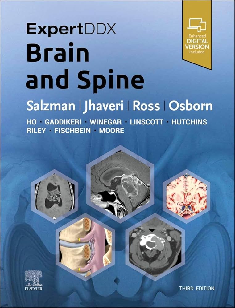 ExpertDDx: Brain and Spine : Salzman, Karen L., Jhaveri, Miral D