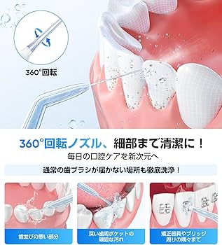 Amazon.co.jp: 口腔洗浄器 ジェットウォッシャー 歯垢除去率99.9% 4