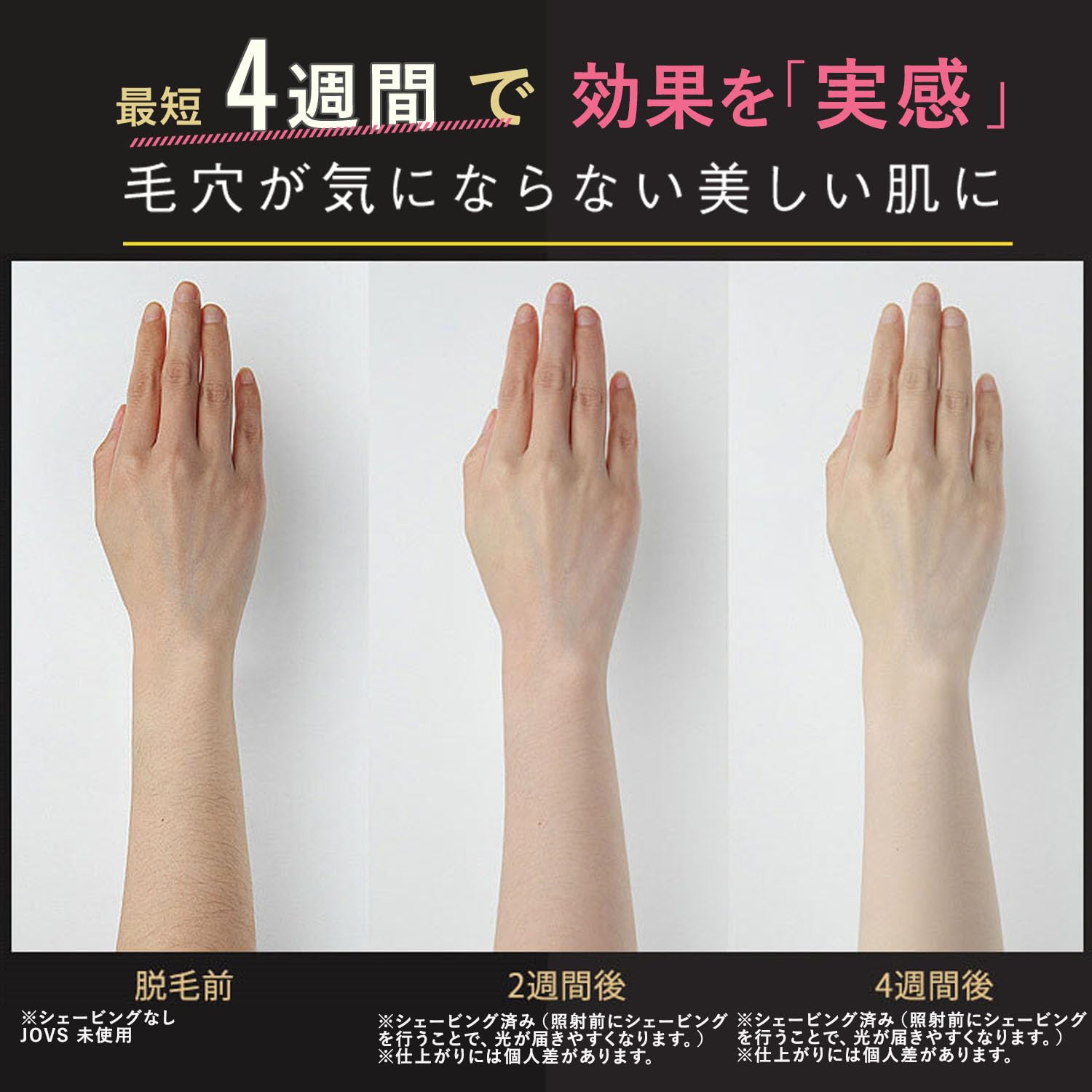 Amazon.co.jp: JOVS Dora J847モデル 脱毛器 家庭用 光美容器 VIO対応