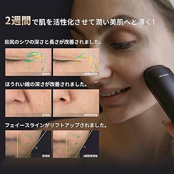 Amazon.co.jp: AMIRO 美顔器 EMS 1台10役 ラジオ波 RF美容器 肌