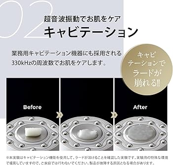 Amazon.co.jp: ヤーマン ボディ用美容器 キャビスパ RFコア PLUS