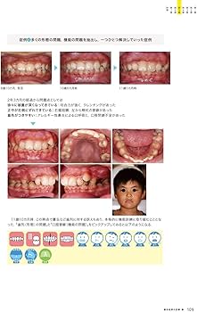 71MS-mNzN7L._AC_UF350,