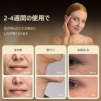 Amazon.co.jp: MEGELIN V 美顔器 リフトケア 肌引き締め 表情筋ケア