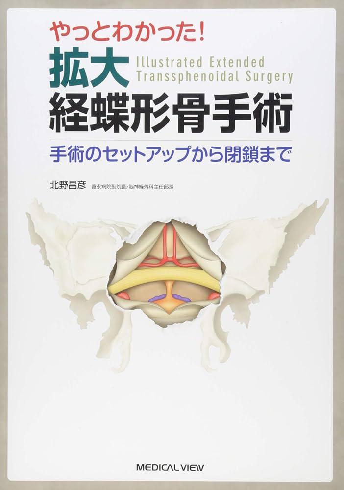 やっとわかった! 拡大経蝶形骨手術−手術のセットアップから閉鎖まで