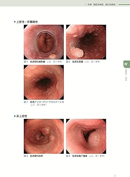 消化管内視鏡診断テキスト I 食道・胃・十二指腸 第5版 (消化器画像