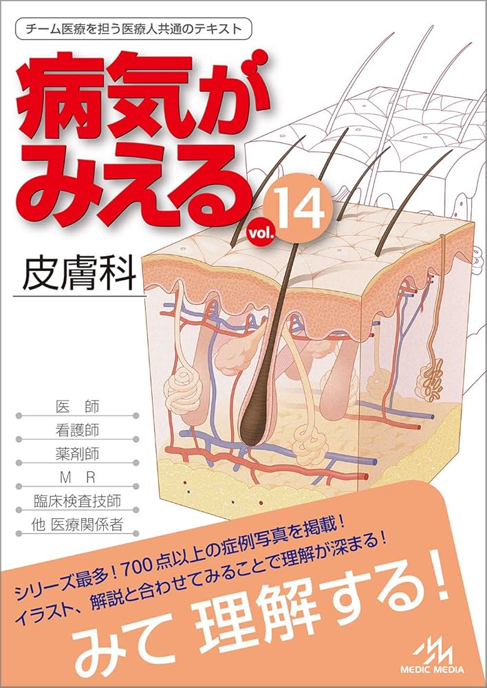 Amazon.co.jp: 病気がみえる vol.14 皮膚科 第1版 : 医療情報科学研究
