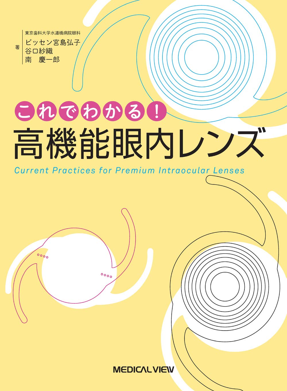 これでわかる! 高機能眼内レンズ | ビッセン宮島 弘子, 谷口 紗織, 南