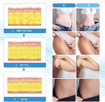 Amazon.co.jp: Muokd 4in1 家庭用/業務用 キャビテーション 40khz 光