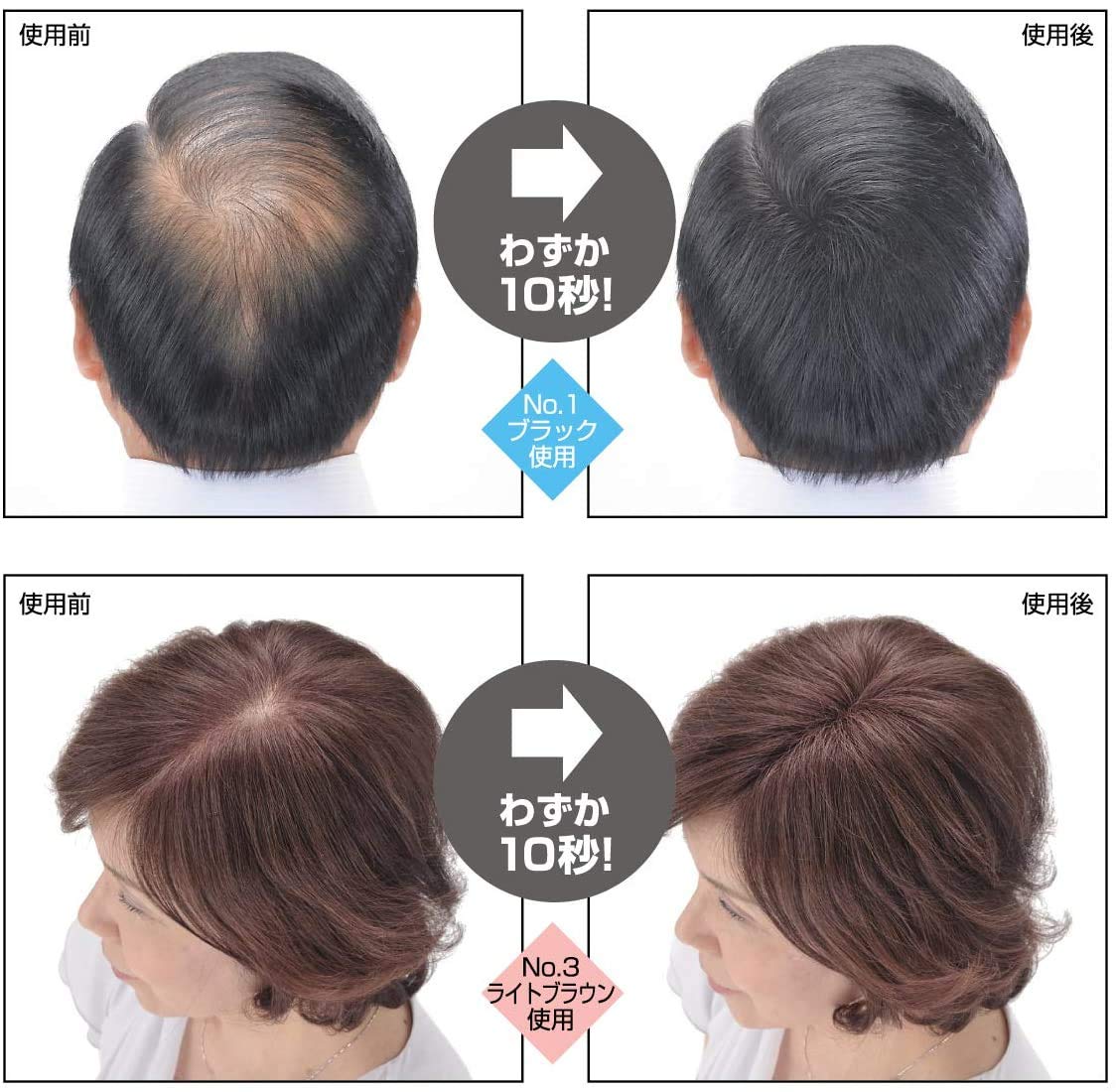 Amazon | スーパーミリオンヘアー30g (No.2 ダークブラウン) 薄毛