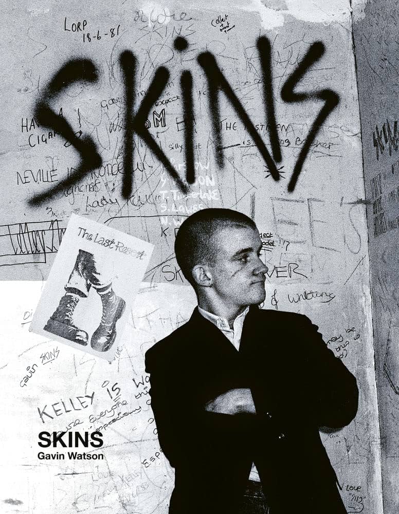 Skins: Gavin Watson (ACC Collector's Editions) : Watson, Gavin