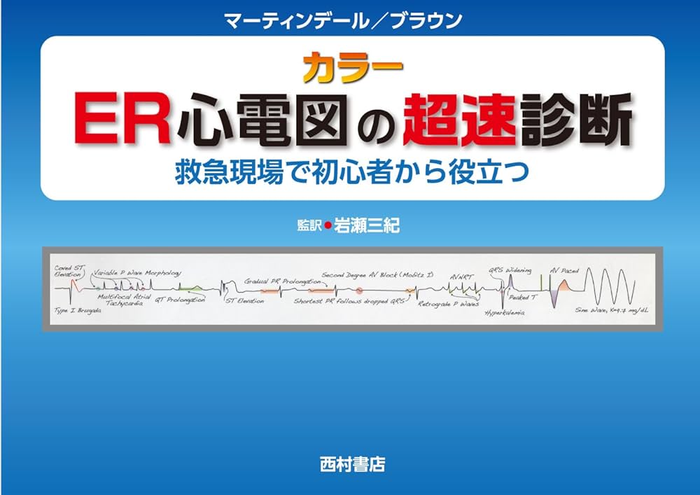 ER心電図の超速診断: 救急現場で初心者から役立つ | J.L.マーティン