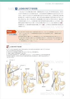 ベーシックな脊椎除圧術のすべて (新OS NEXUS No.3) | 今釜 史郎 |本