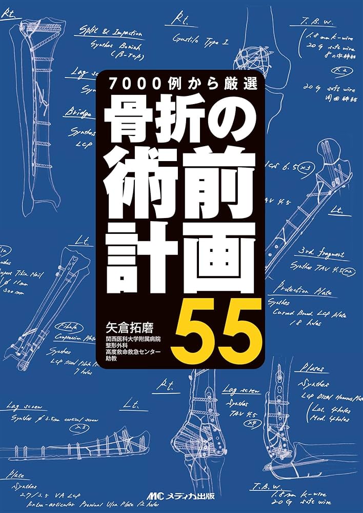 骨折の術前計画55: 7000例から厳選 | 矢倉 拓磨 |本 | 通販 | Amazon