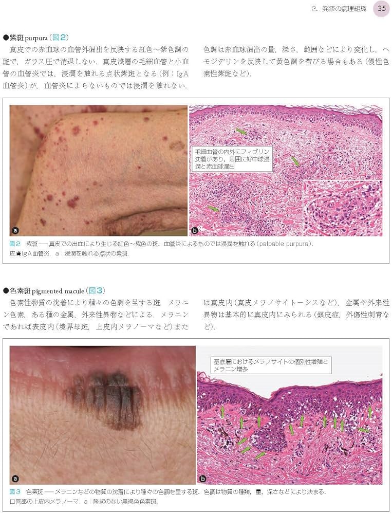 1冊でわかる皮膚病理 第2版 (皮膚科サブスペシャリティーシリーズ