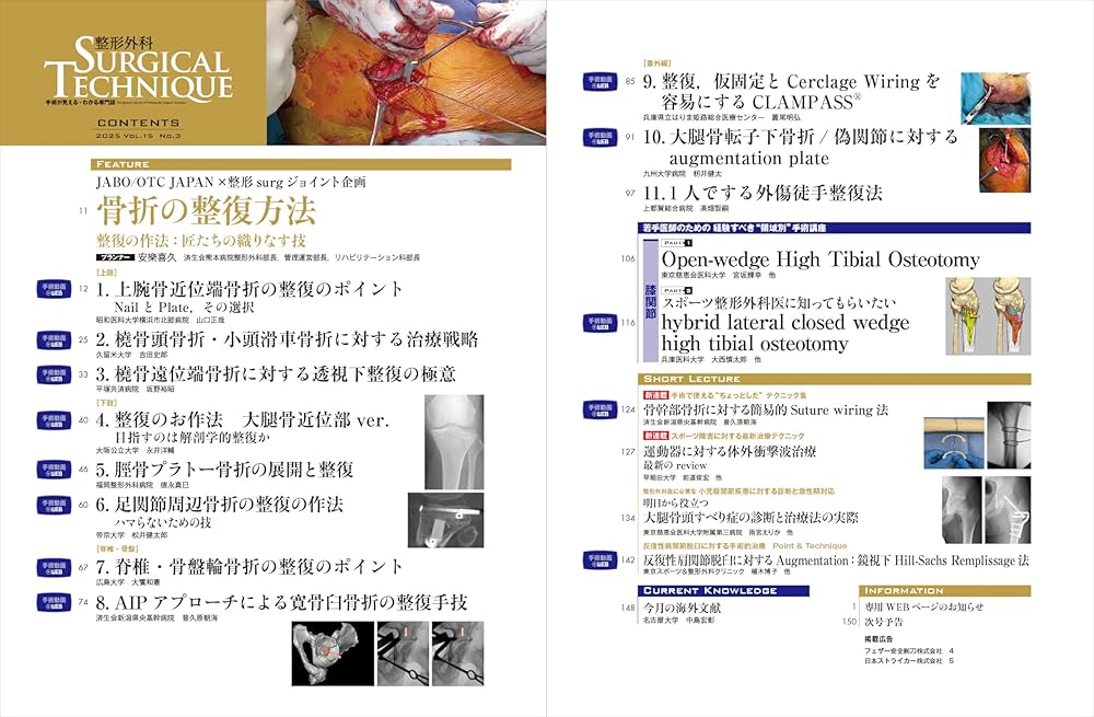 整形外科サージカルテクニック 2025年3号〈特集〉骨折の整復方法（第15