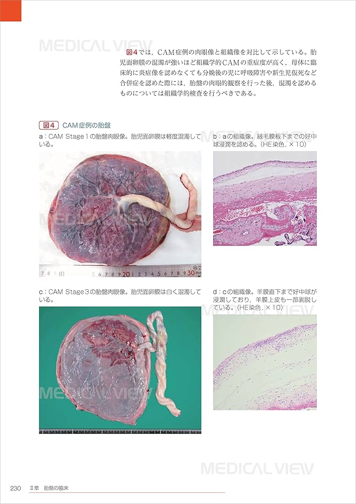 基礎と臨床の両側面からみた 胎盤学 | 日本胎盤学会 |本 | 通販 | Amazon