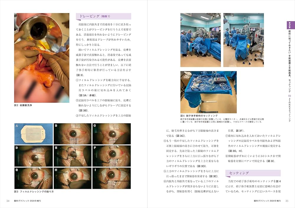 網膜硝子体手術：基本と応用，トラブル＆リカバリーがわかる！ (眼科