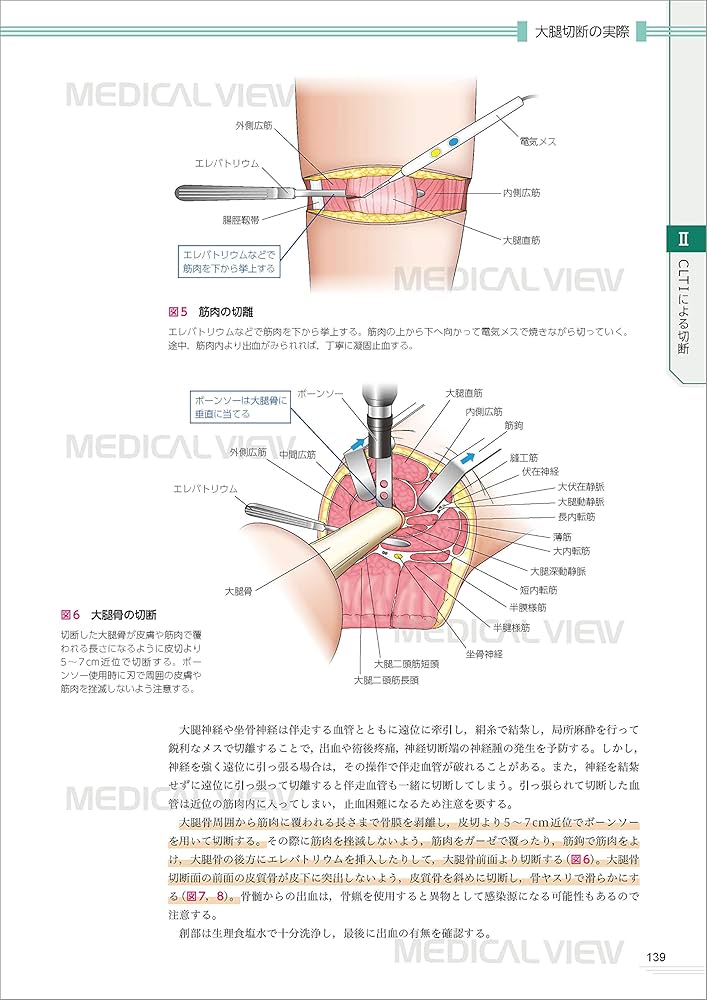 Amazon.co.jp: 四肢切断術のすべて［Web動画付］ : 田中 康仁, 富村