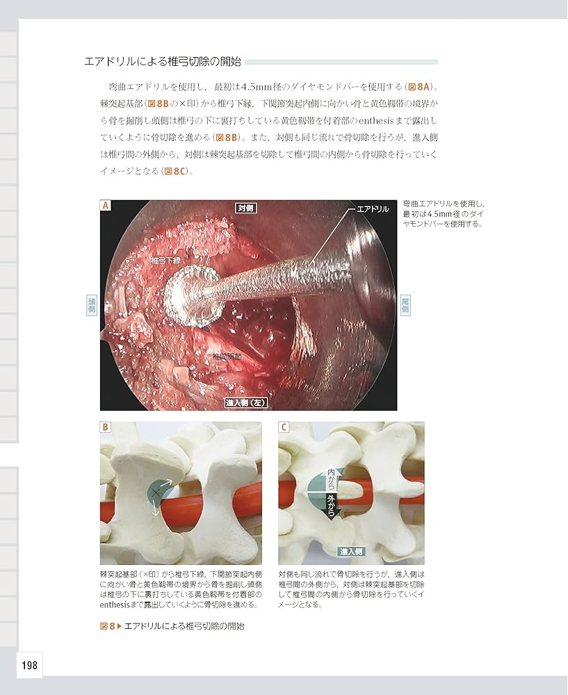 整形外科医のための脊椎のアドバンスト手術 | 石井 賢 |本 | 通販 | Amazon