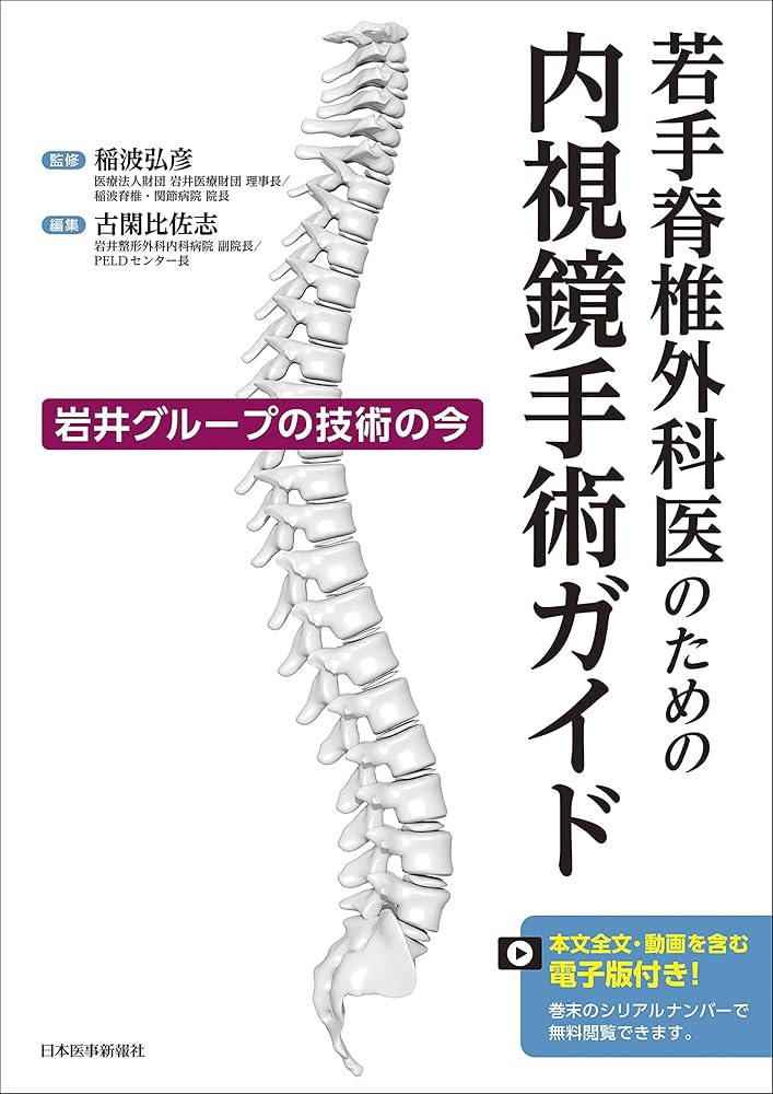 若手脊椎外科医のための内視鏡手術ガイド 岩井グループの技術の今