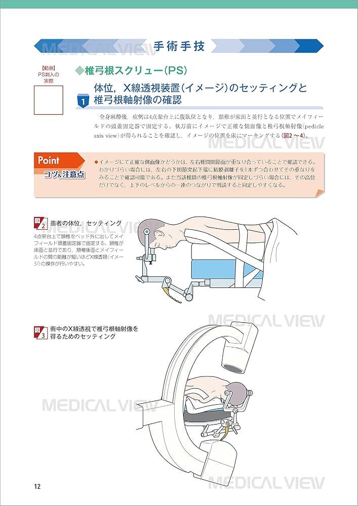 脊椎固定術の基本手技［Web動画付］ (新OS NEXUS No.6) | 今釜 史郎