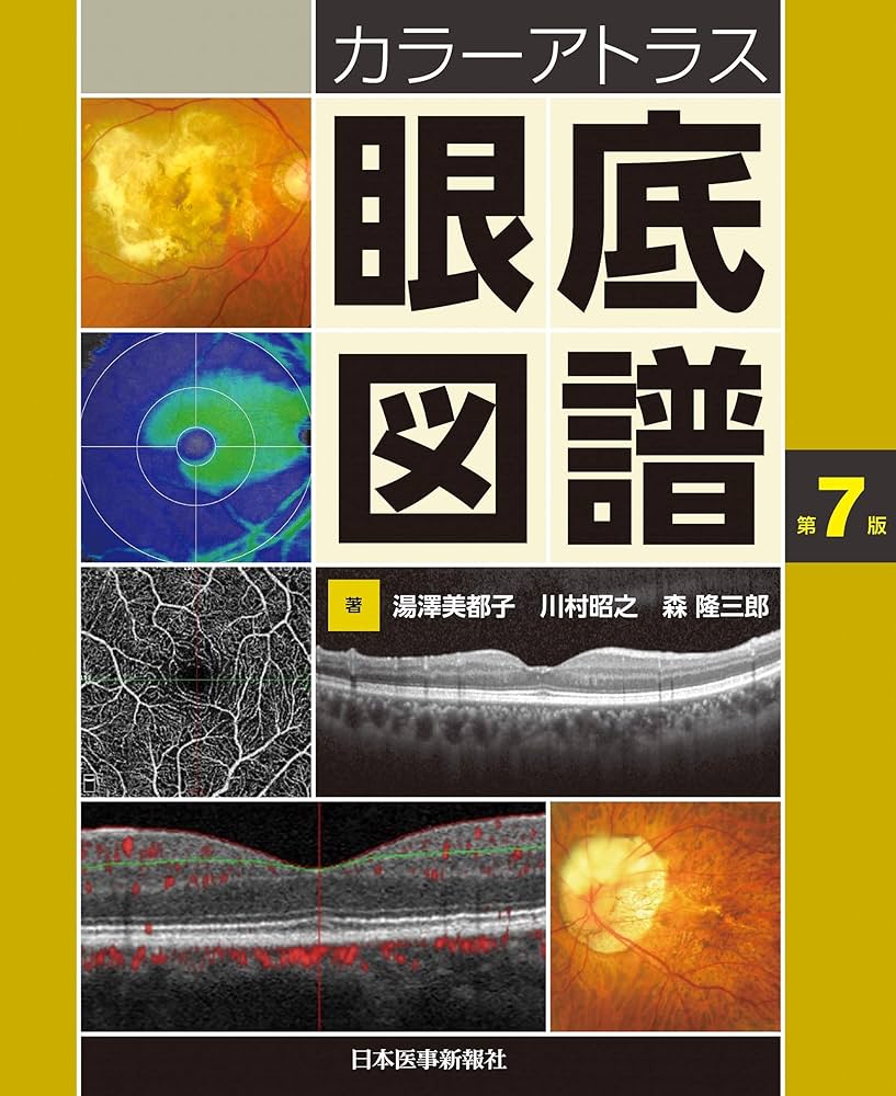 カラーアトラス眼底図譜 | 湯澤美都子, 川村昭之, 森隆三郎 |本 | 通販