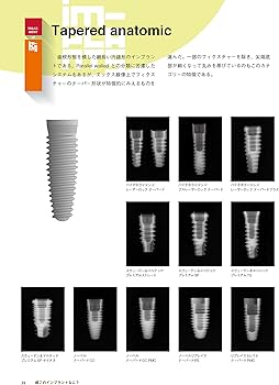 続・このインプラントなに? 他医院で治療されたインプラントへの対応
