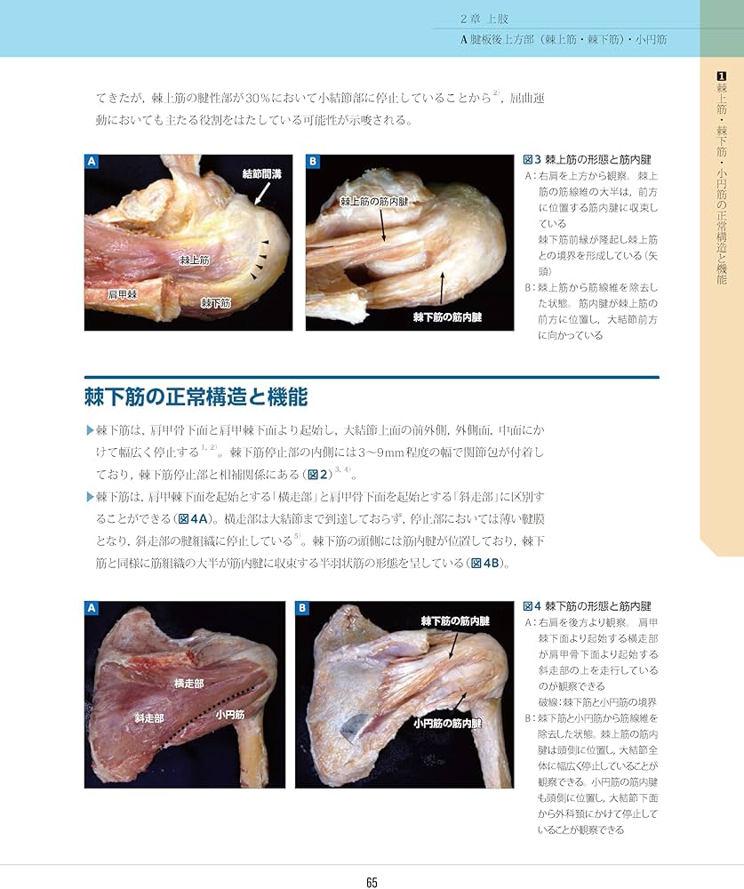 スポーツ障害〉筋損傷のエコー活用術 ―電子版付― | 和田 誠, 熊井 司