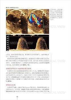 胎児心エコーのすべて−スクリーニング・精査・治療・そして家族支援