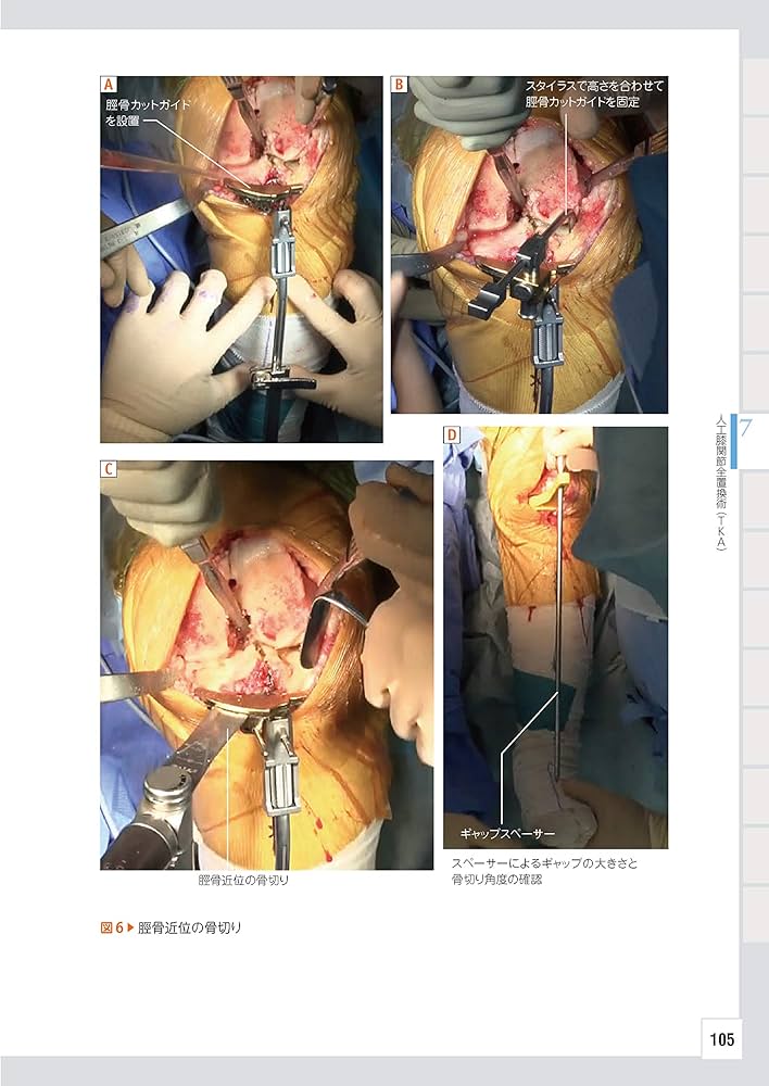 整形外科レジデントのための下肢のベーシック手術【電子版付】 | 大内