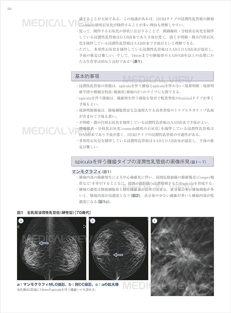 乳房 画像診断の勘ドコロNEO | 角田 博子 |本 | 通販 | Amazon