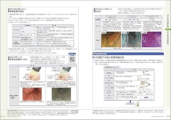 病気がみえる vol.1 消化器 第6版 | 医療情報科学研究所 |本 | 通販