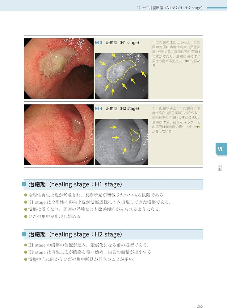 Amazon.co.jp: 消化管内視鏡診断テキスト I 食道・胃・十二指腸 第5版