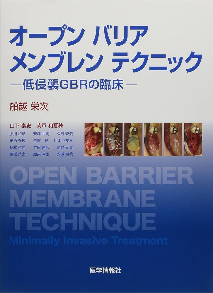 Amazon.co.jp: オープンバリアメンブレンテクニック: 低侵襲GBRの臨床